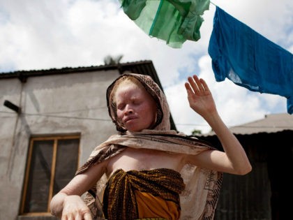 TO GO WITH AFP STORY BY OTTO BAKANO Fatuma Sultan (R), a Tanzanian albino and the sister of albino member of Tanzania's Albino United football club Fikiri Sultan, hangs clothes to dry in front of her home in Dar es Salaam on November 3, 2010. Albinism is a genetically inherited …