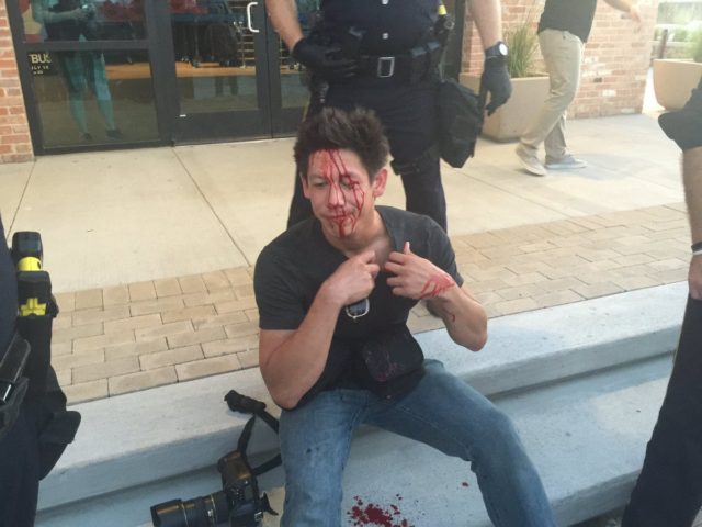 reporter bloodied by rock thrown at Trump event in Dallas, June 16, 2016.