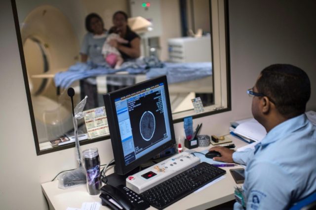 Doctors scan the brain of a newborn to detect a possible microcephalia, at the Obras Socia