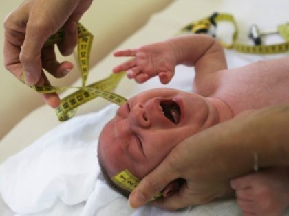 Doctor measures the head of a 2-month-old baby with microcephaly on January 27, 2016 in Re