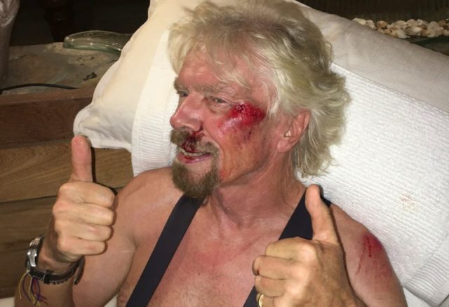 British billionaire Richard Branson gives a thumbs up showing injuries after a biking acci