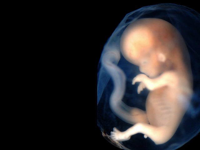 unborn baby