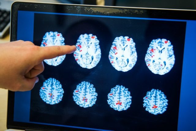 Scientists can now predict whether someone will lie by looking at brain scans