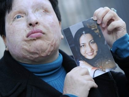 Iranian Ameneh Bahrami poses on March 5, 2009 in Barcelona holding a photograph of herself before she was blinded by a man who threw acid in her face. In 2008 an Iranian court ruled that the man -- identified only as Majid -- a spurned suitor who poured a bucket …