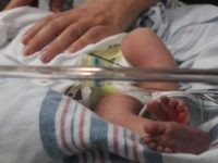 Babies Drug Dependency Babies Drug Dependency