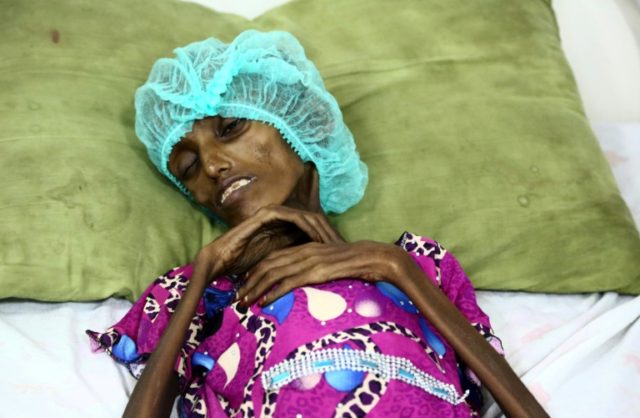 Saida Ahmad Baghili, an 18-year-old Yemeni woman lies in bed at the al-Thawra hospital in