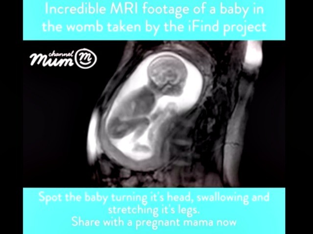 MRI Shows Detailed Images of 20-Week Unborn Babies - Breitbart