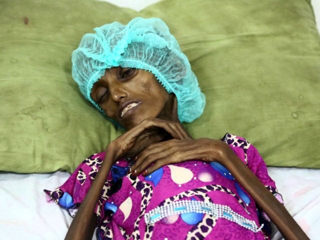 Saida-Ahmad-Baghili-18-yr-old-Yemeni-malnutrition-afp