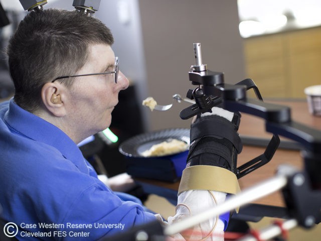 Bill Kochevar controls his arm for the first time in 8 years using the Braingate2 technolo