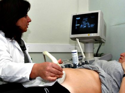 A pregnant Albanin woman watches her baby in the monitor as a doctor performs a sonogram i