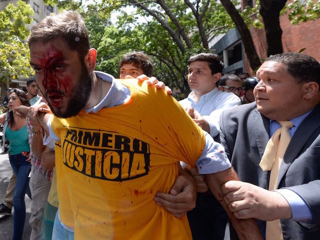 People try to calm down Venezuelan opposition deputy Juan Requesens (L) after he was hit i