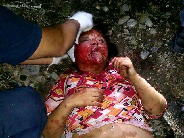 GRAPHIC TERROR: Mexican Cartel Tried to Burn Woman Alive.