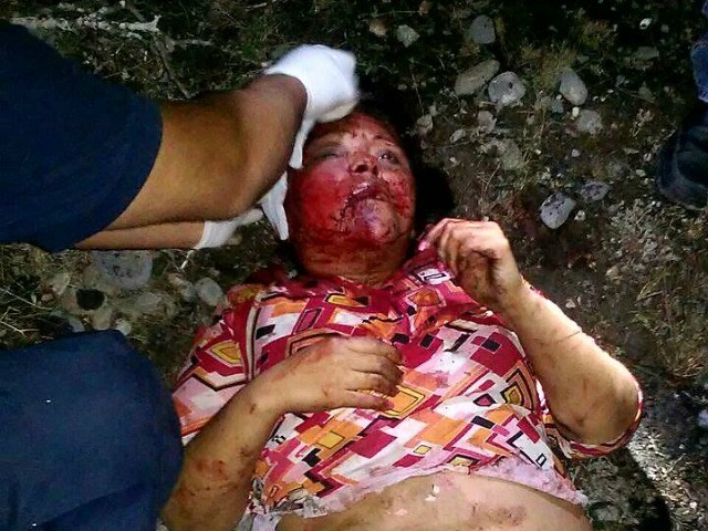 GRAPHIC TERROR: Mexican Cartel Tried to Burn Woman Alive 