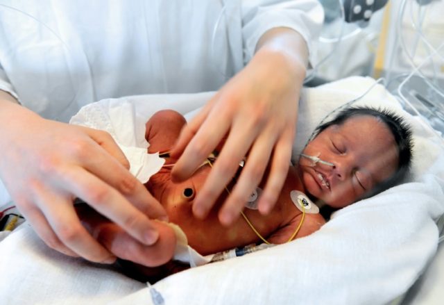 An artificial womb, tested on pre-natal lambs, could help extremely premature babies avoid