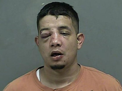 Police say a woman beat Joe M. Sotello with a baseball bat after he allegedly to rob her.