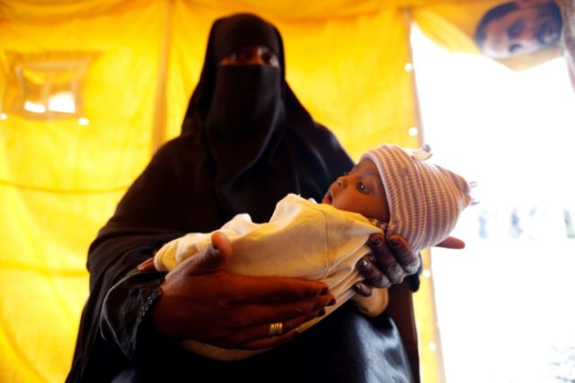 A Yemeni mother holds her child suspected of being infected with cholera at a makeshift ho
