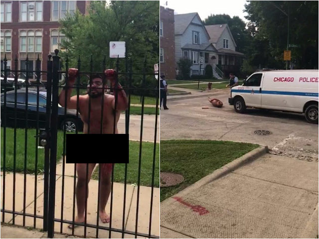 GRAPHIC VIDEO: Naked Chicago Man with Self-Inflicted Penis Wound Rushes Police