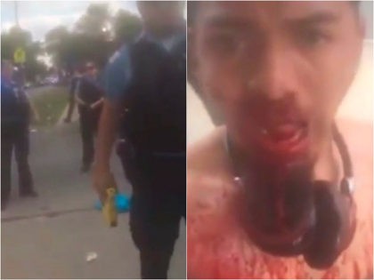 VIDEO: Alleged Gang Member, Accused of Stabbing 3 Women, Livestreams Chicago Street Fight