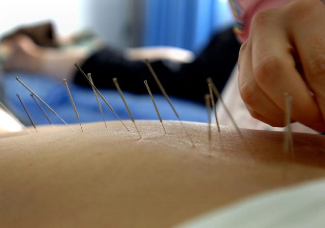 Acupuncture is one form of alternative medicine that cancer patients sometimes choose over