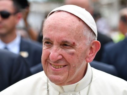 TOPSHOT - Pope Francis, showing a bruise around his left eye and eyebrow caused by an acci
