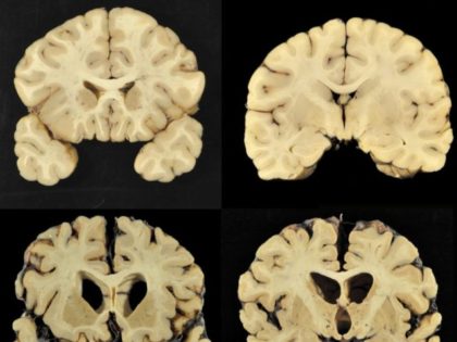 The Associated Press