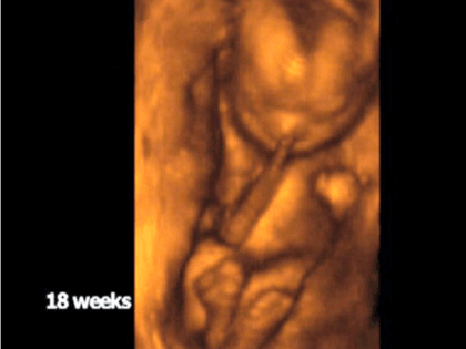 Fetus 18 Weeks Getty Images