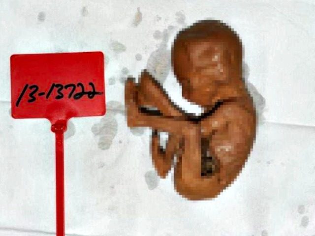 Preserved Human Fetus