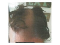 barber-cuts-down-middle-hair-Madison-Police-Dept Khaled A. Shabani, 46, a Wisconsin barber, is accused of giving one customer the haircut from hell after he allegedly snipped the man’s ear on purpose and shaved his head down the middle.