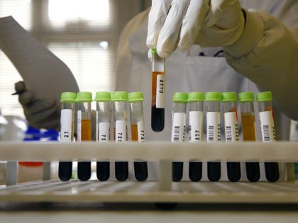 Pathologist organizing blood sample onto test tube holder (Photo by Universal Images Group via Getty Images)