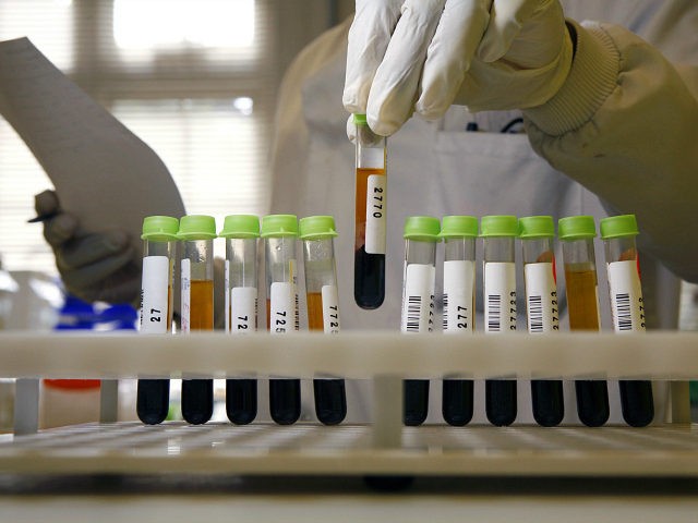 Pathologist organizing blood sample onto test tube holder (Photo by Universal Images Group