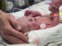 Doctors: Over a year to see if uterus transplant successful Photo AP Photo