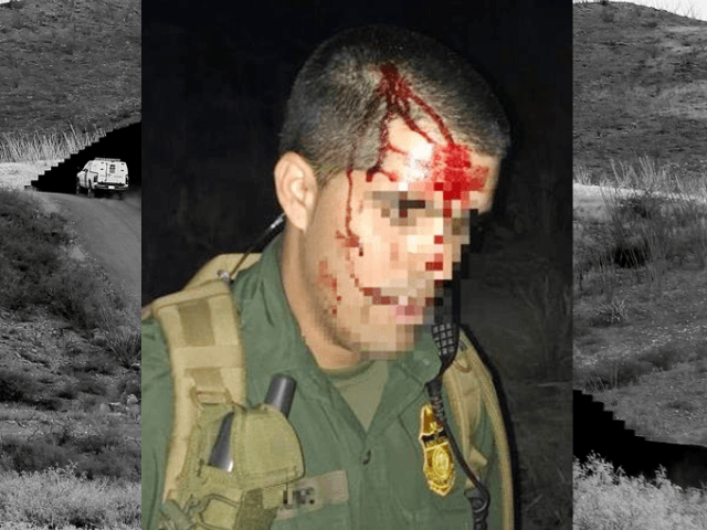 7 Times Migrants Assaulted Border Patrol Agents With Rocks