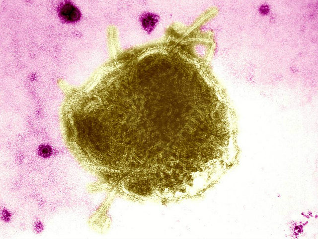 This Electron Micrograph Reveals Both A Paramyxovirus Measles Virus, And Virions Of The Polyomavirus, Simian Virus Sv40 Smaller Circles. The Envelope Of The Measles Virus Has Broken, Exposing The Nucleocapsid Filaments. Interest In Sv40 Has Increased In The Last Several Years Because The Virus Was Found In Certain Forms Of …