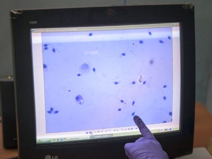A research assistant points to live sperm samples displayed on a monitor at the artificial