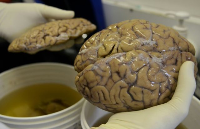 No new 'learning' brain cells after age 13: study