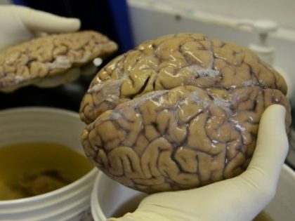 No new 'learning' brain cells after age 13: study