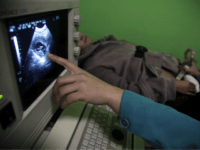 In this photo taken Monday, Dec. 13, 2010, a nurse points out the image of a three-month-old fetus during a sonogram scan for "Nancy" Yin at a clinic run by Marie Stopes International in Xi'an in central China's Shaanxi province. While comprehensive data are hard to come by, official figures show abortions are increasing, and Chinese media and experts say many if not most of the abortion-seekers are young, single women. (AP Photo/Ng Han Guan)