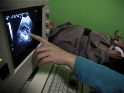 In this photo taken Monday, Dec. 13, 2010, a nurse points out the image of a three-month-old fetus during a sonogram scan for "Nancy" Yin at a clinic run by Marie Stopes International in Xi'an in central China's Shaanxi province. While comprehensive data are hard to come by, official figures …