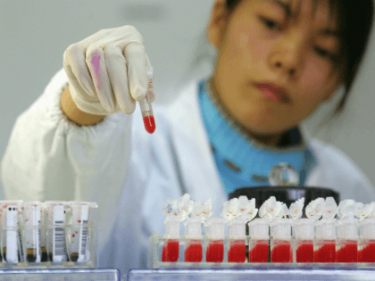 SHANGHAI, CHINA - DECEMBER 6: (CHINA OUT) A worker performs a CD4 HIV test at a lab of Shanghai Xuhui District Central Hospital on December 6, 2006 in Shanghai, China. Shanghai's medical researchers have made breakthrough progress in the development of CD4 test reagent, which can largely lower the expense …