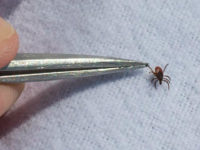 tick-tweezers-getty SCARBOROUGH, ON - MAY 17: City of Toronto Public Health Worker Serban Grigoras drags a white sheet in a grassy area in Rouge Park off Twyn Rivers Dr., Scarborough, in a search for black legged ticks. Lyme disease is on the rise as black legged ticks continue their spread across …