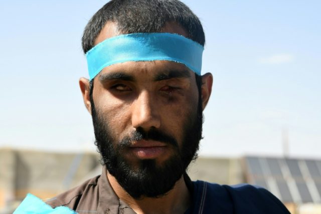Blistered and hungry: Afghans walk hundreds of kilometres for peace