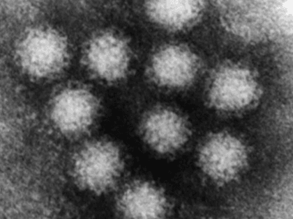 This undated Negative-stain Transmission Electron Microscopy image, provided by the U.S. E