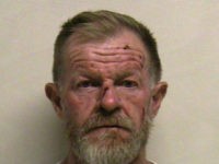 Duane-Youd-bruised-face-ap This photo provided by the Utah County Sheriff's Office shows Duane Youd. Youd, of Utah, flew a small plane into his own house early Monday, Aug. 13, 2018, just hours after he had been arrested for assaulting his wife in a nearby canyon where the couple went to talk over …