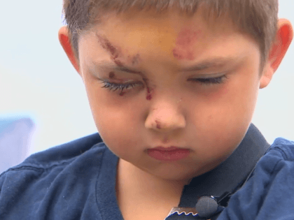 A 6-year-old boy in Olympia was assaulted after he says he stood up to a group of kids who were bullying his friend. (KOMO News)