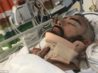 Father of two, Brad Lewis, 42, was critically injured and remains in ICU following an incident where he and his son plunged 4m from a balcony onto a cement driveway while playing at a friend's home in Sydney last Saturday, 4th August 2018. Father of two, Brad Lewis, 42, was critically injured and remains in ICU following an incident where he and his son plunged 4m from a balcony onto a cement driveway while playing at a friend's home in Sydney last Saturday, 4th August 2018.