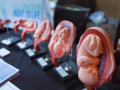 TINLEY PARK, IL - JULY 31: Stages of a fetus are displayed at the Illinois Right To Life a table while Republican presidential hopeful and former Arkansas Governor Mike Huckabee speaks at the Freedom's Journal Institute for the Study of Faith and Public Policy 2015 Rise Initiative on July 31, …