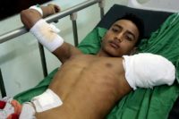 An injured Yemeni man lies in a hospital bed as he receives treatments after being wounded during a reported air strike on the Red Sea port city of Hodeida on August 3