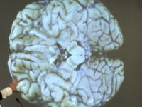 brain-cte-AP AP Photo/Steven Senne