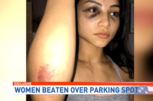 Anjelica Lozano appears badly bruised and scraped up following an alleged assault over a parking spot dispute. (Photo: WOAI Video Screenshot)