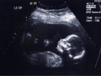 baby-ultrasound-photo-flickr ultrasound photo